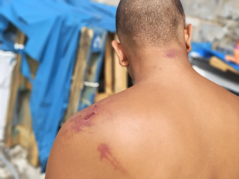 “أمنيستي” تتهم عسكريين إسبان بتعذيب مهاجرين في سبتة المحتلة
